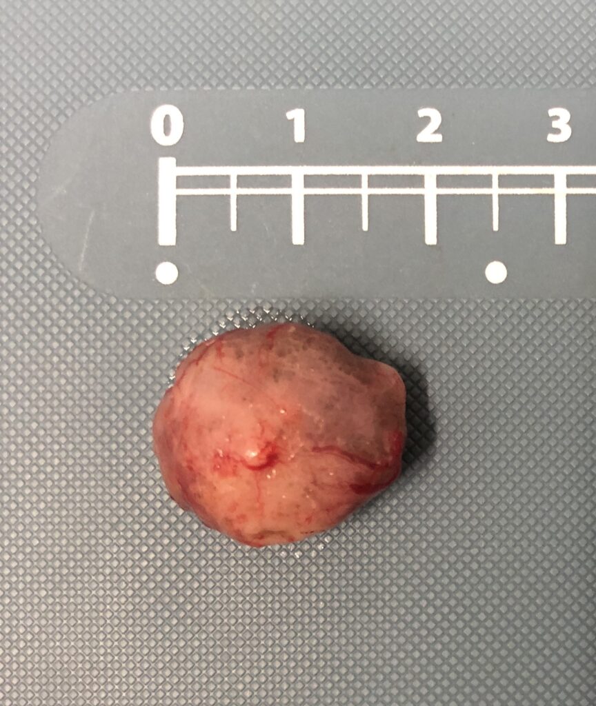 ハムスターの皮膚腫瘤切除