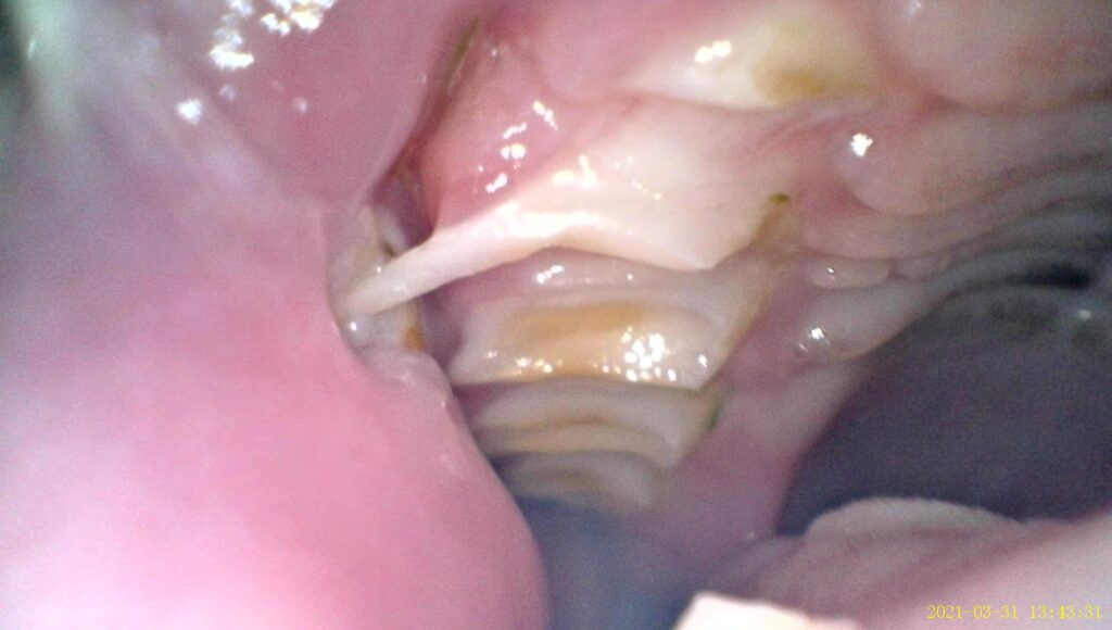 ウサギの臼歯過長整復 処置前