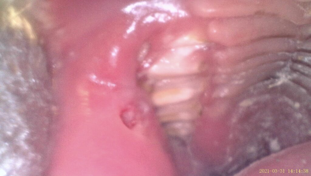 ウサギの臼歯過長整復 処置後